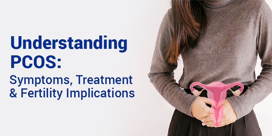 Understanding PCOS: Symptoms, Treatment, and Fertility Implications